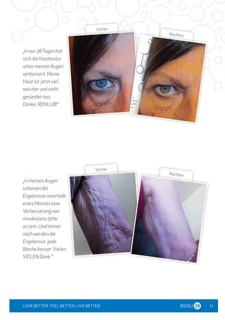 11
LOOK BETTER. FEEL BETTER. LIVE BETTER.
„In nur 28Tagen hat
sich die Hauttextur
unter meinen Augen
verbessert. Meine
Haut ist jetzt viel
weicher und sieht
gesünder aus.
Danke, RENU 28!"
„In meinen Augen
scheinen die
Ergebnisse innerhalb
eines Monats eine
Verbesserung von
mindestens 50%
zu sein. Und immer
noch werden die
Ergebnisse jede
Woche besser.Vielen,
VIELEN Dank."
Vorher
Nachher
Vorher
Nachher
 