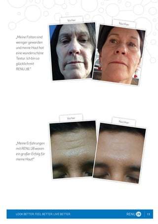 13
LOOK BETTER. FEEL BETTER. LIVE BETTER.
„Meine Falten sind
weniger geworden
und meine Haut hat
eine wunderschöne
Textur. Ich bin so
glücklich mit
RENU 28."
„Meine Erfahrungen
mit RENU 28 waren
ein großer Erfolg für
meine Haut!"
Vorher
Nachher
Vorher
Nachher
 
