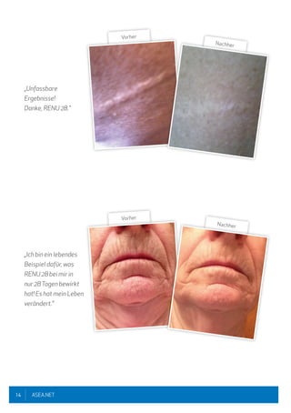 14 ASEA.NET
„Unfassbare
Ergebnisse!
Danke, RENU 28."
„Ich bin ein lebendes
Beispiel dafür, was
RENU 28 bei mir in
nur 28Tagen bewirkt
hat! Es hat mein Leben
verändert."
Vorher
Nachher
Vorher
Nachher
 