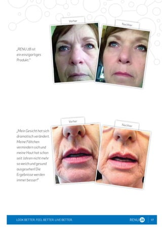 17
LOOK BETTER. FEEL BETTER. LIVE BETTER.
„RENU 28 ist
ein einzigartiges
Produkt."
„Mein Gesicht hat sich
dramatisch verändert.
Meine Fältchen
vermindern sich und
meine Haut hat schon
seit Jahren nicht mehr
so weich und gesund
ausgesehen! Die
Ergebnisse werden
immer besser!"
Vorher
Nachher
Vorher
Nachher
 