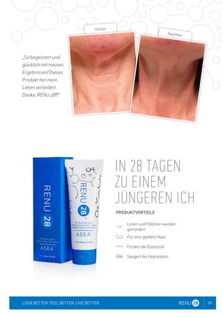 19
LOOK BETTER. FEEL BETTER. LIVE BETTER.
„So begeistert und
glücklich mit meinen
Ergebnissen! Dieses
Produkt hat mein
Leben verändert.
Danke, RENU 28!!!"
IN 28 TAGEN
ZU EINEM
JÜNGEREN ICH
Linien und Fältchen werden
gemindert
Für eine glattere Haut
Fördert die Elastizität
Steigert die Hydratation
PRODUKTVORTEILE
Vorher
Nachher
 