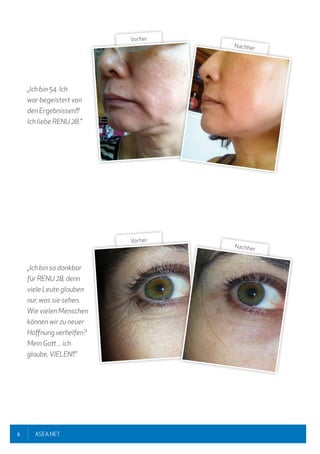 6 ASEA.NET
„Ich bin 54. Ich
war begeistert von
den Ergebnissen!!!
Ich liebe RENU 28."
„Ich bin so dankbar
für RENU 28, denn
viele Leute glauben
nur, was sie sehen.
Wie vielen Menschen
können wir zu neuer
Hoffnung verhelfen?
Mein Gott ... ich
glaube,VIELEN!!"
Vorher
Nachher
Vorher
Nachher
 