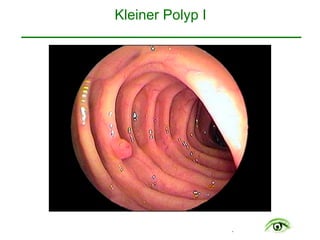 .
Kleiner Polyp I 
 
