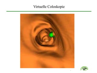 .
Virtuelle Coloskopie
 