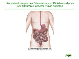 .
Kapselendoskopie des Dünndarms und Dickdarms die wir
seit 9Jahren in unserer Praxis anbieten
 