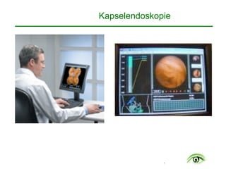 .
Kapselendoskopie
 