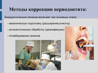 Методы коррекции периодонтита:
Эндодонтическое лечение включает три основных этапа:
- механическую подготовку (расширение,очистку)
- антисептическую обработку (дезинфекцию)
- пломбирование каналов.
 