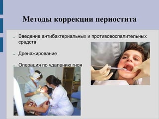 Методы коррекции периостита
● Введение антибактериальных и противовоспалительных
средств
● Дренажирование
● Операция по удалению гноя
 