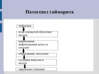 Патогенез гайморита
 