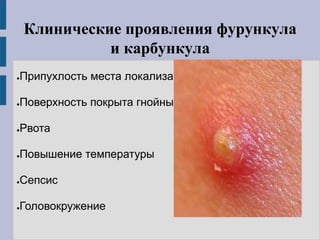 Клинические проявления фурункула
и карбункула
●Припухлость места локализации
●Поверхность покрыта гнойными образованиями
●Рвота
●Повышение температуры
●Сепсис
●Головокружение
 