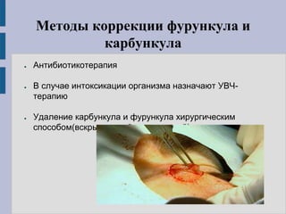 Методы коррекции фурункула и
карбункула
● Антибиотикотерапия
● В случае интоксикации организма назначают УВЧ-
терапию
● Удаление карбункула и фурункула хирургическим
способом(вскрытие гнойных полостей)
 