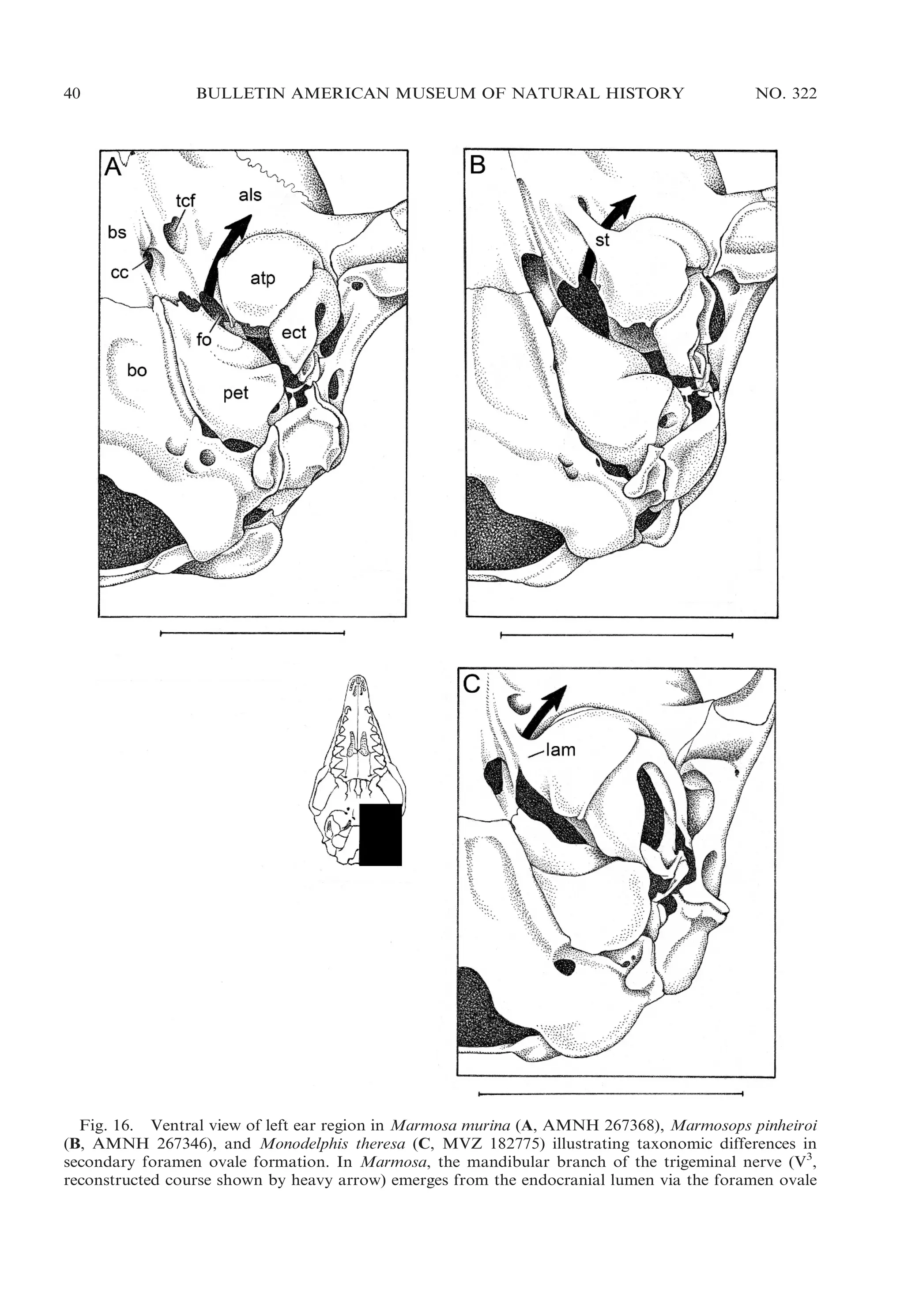 40

BULLETIN AMERICAN MUSEUM OF NATURAL HISTORY

NO. 322

Fig. 16. Ventral view of left ear region in Marmosa murina (A, AMNH 267368), Marmosops pinheiroi
(B, AMNH 267346), and Monodelphis theresa (C, MVZ 182775) illustrating taxonomic differences in
secondary foramen ovale formation. In Marmosa, the mandibular branch of the trigeminal nerve (V3,
reconstructed course shown by heavy arrow) emerges from the endocranial lumen via the foramen ovale

 