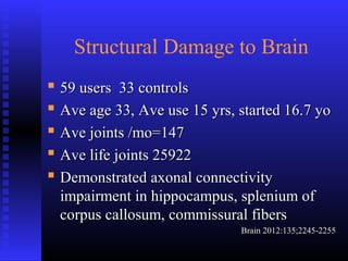 Structural Damage to Brain
 59 users 33 controls59 users 33 controls
 Ave age 33, Ave use 15 yrs, started 16.7 yoAve age 33, Ave use 15 yrs, started 16.7 yo
 Ave joints /mo=147Ave joints /mo=147
 Ave life joints 25922Ave life joints 25922
 Demonstrated axonal connectivityDemonstrated axonal connectivity
impairment in hippocampus, splenium ofimpairment in hippocampus, splenium of
corpus callosum, commissural fiberscorpus callosum, commissural fibers
Brain 2012:135;2245-2255Brain 2012:135;2245-2255
 