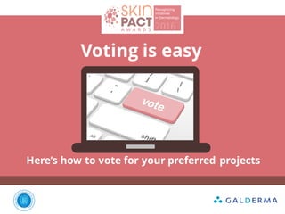 Voting is easy
Here’s how to vote for your preferred projects
 