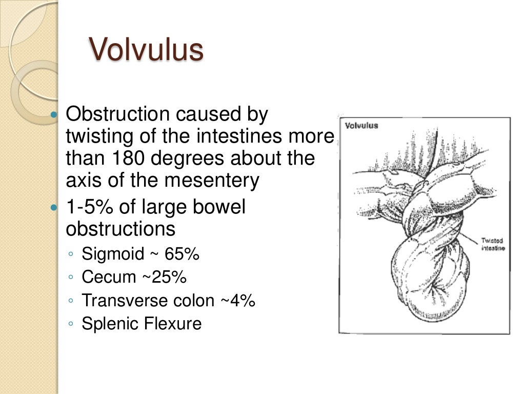 Volvulus