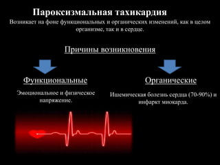 Пароксизмальная тахикардия
Возникает на фоне функциональных и органических изменений, как в целом
организме, так и в сердце.
Причины возникновения
Функциональные Органические
Эмоциональное и физическое
напряжение.
Ишемическая болезнь сердца (70-90%) и
инфаркт миокарда.
 