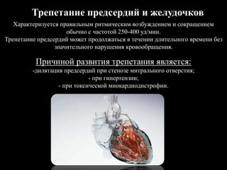 Трепетание предсердий и желудочков
Характеризуется правильным ритмическим возбуждением и сокращением
обычно с частотой 250-400 уд/мин.
Трепетание предсердий может продолжаться в течении длительного времени без
значительного нарушения кровообращения.
Причиной развития трепетания является:
-дилятация предсердий при стенозе митрального отверстия;
- при гипертензии;
- при токсической миокардиодистрофии.
 