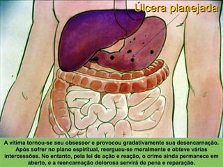 Úlcera planejadaÚlcera planejada
XAVIER, Francisco Cândido.XAVIER, Francisco Cândido. Missionários da luz. Pelo Espírito André Luiz. ed. esp. Rio de Janeiro:Missionários da luz. Pelo Espírito André Luiz. ed. esp. Rio de Janeiro:
FEB, 2003. Primeira Parte: Cap. 12. p. 167-193 (Desenhos de Rodval Matias: Estúdio Cena &FEB, 2003. Primeira Parte: Cap. 12. p. 167-193 (Desenhos de Rodval Matias: Estúdio Cena &
Ação. Produção S. E. Mãos Unidas)Ação. Produção S. E. Mãos Unidas)
A vítima tornou-se seu obsessor e provocou gradativamente sua desencarnação.
Após sofrer no plano espiritual, reergueu-se moralmente e obteve várias
intercessões. No entanto, pela lei de ação e reação, o crime ainda permanece em
aberto, e a reencarnação dolorosa servirá de pena e reparação.
 
