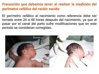 El perímetro cefálico al nacimiento como referencia debe ser
tomado entre 24 a 48 horas después del nacimiento, ya que al
pasar por el canal del parto sufre modificaciones que en este
periodo se consideran corregidas.
Glabela
 