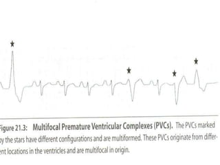 Vpcs | PPTX