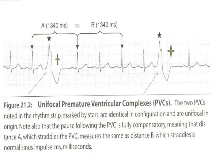 Vpcs