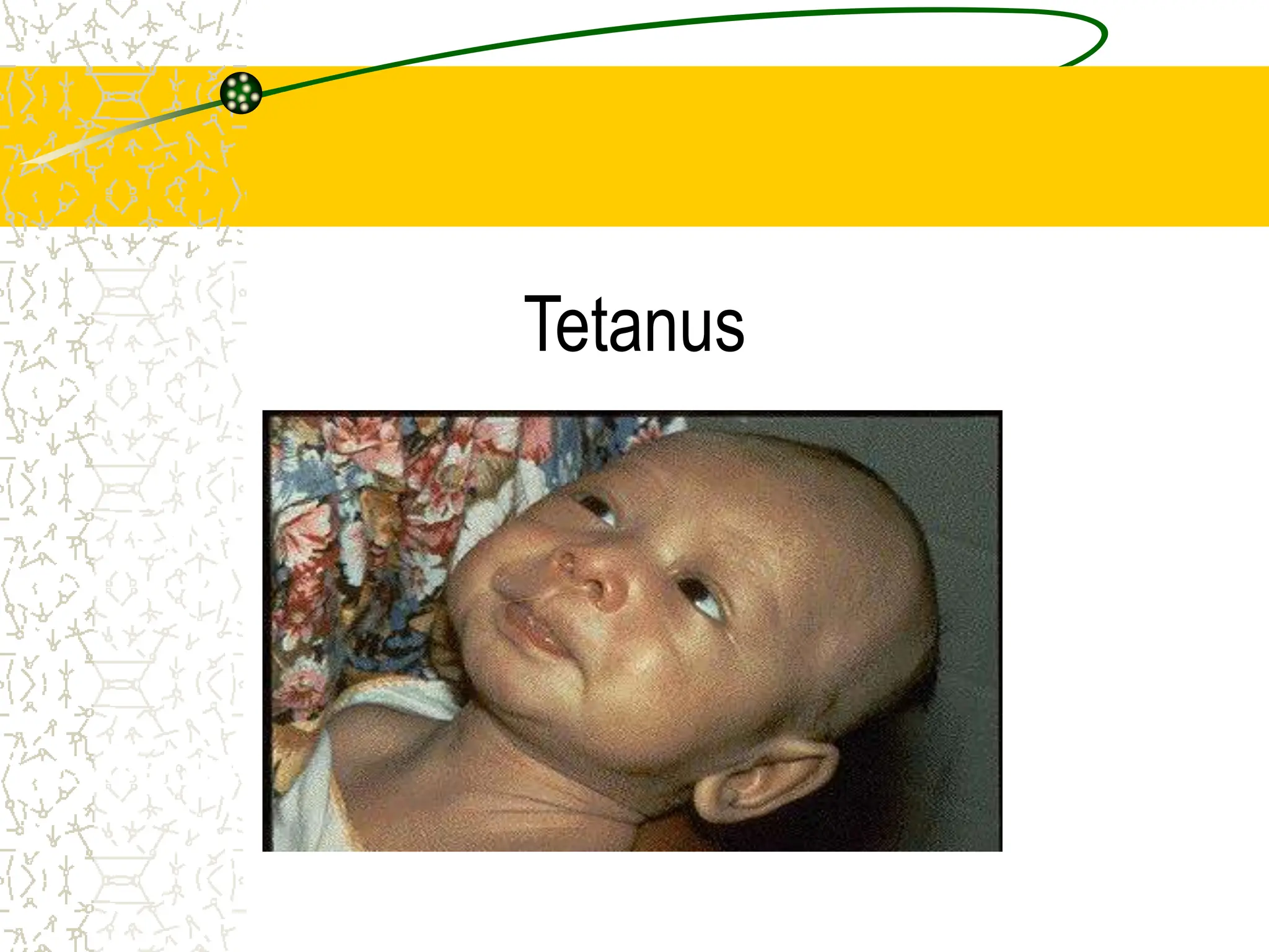 Tetanus
Epidemiology and Prevention of Vaccine-
Preventable Diseases
National Immunization Program
Centers for Disease Control and Prevention
Revised March 2002
 