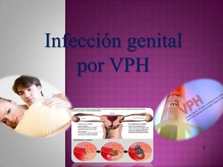 Infección genital
por VPH
 