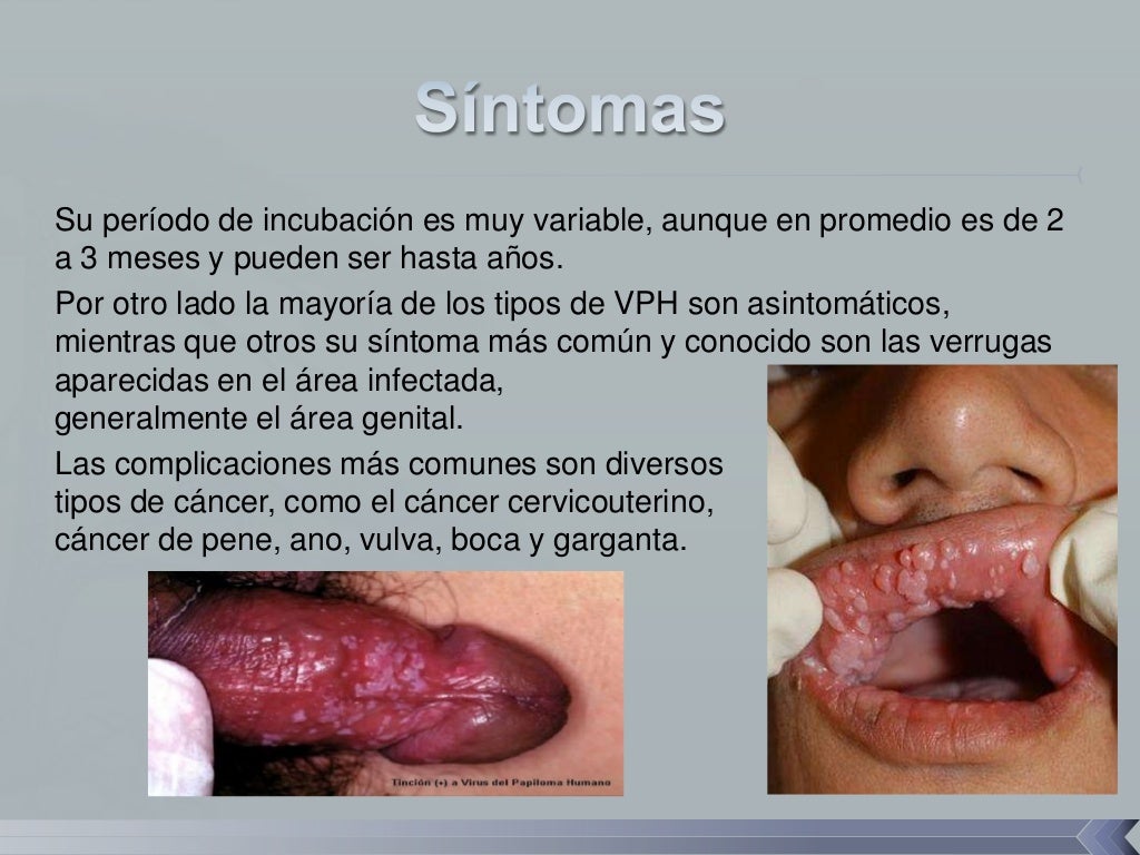 Sintomas del papiloma humano en las mujeres juniper networks ccna