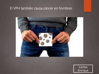 Carlos
Enrique
El VPH también causa cáncer en hombres
 