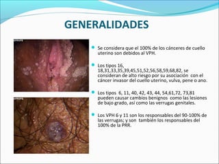 GENERALIDADES
 Se considera que el 100% de los cánceres de cuello
uterino son debidos al VPH.
 Los tipos 16,
18,31,33,35,39,45,51,52,56,58,59,68,82, se
consideran de alto riesgo por su asociación con el
cáncer invasor del cuello uterino, vulva, pene o ano.
 Los tipos 6, 11, 40, 42, 43, 44, 54,61,72, 73,81
pueden causar cambios benignos como las lesiones
de bajo grado, así como las verrugas genitales.
 Los VPH 6 y 11 son los responsables del 90-100% de
las verrugas; y son también los responsables del
100% de la PRR.
 