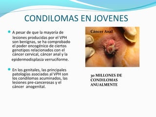 CONDILOMAS EN JOVENES
A pesar de que la mayoría de
lesiones producidas por el VPH
son benignas, se ha comprobado
el poder oncogénico de ciertos
genotipos relacionados con el
cáncer cervical, cáncer anal y la
epidermodisplasia verruciforme.
En los genitales, las principales
patologías asociadas al VPH son
los condilomas acuminados, las
lesiones pre-cancerosas y el
cáncer anogenital.
30 MILLONES DE
CONDILOMAS
ANUALMENTE
Cáncer Anal
 
