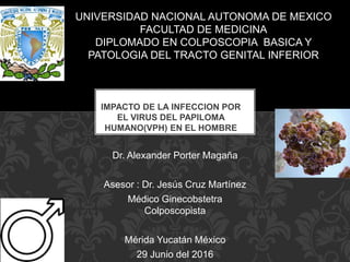 Dr. Alexander Porter Magaña
Asesor : Dr. Jesús Cruz Martínez
Médico Ginecobstetra
Colposcopista
Mérida Yucatán México
29 Junio del 2016
IMPACTO DE LA INFECCION POR
EL VIRUS DEL PAPILOMA
HUMANO(VPH) EN EL HOMBRE
UNIVERSIDAD NACIONAL AUTONOMA DE MEXICO
FACULTAD DE MEDICINA
DIPLOMADO EN COLPOSCOPIA BASICA Y
PATOLOGIA DEL TRACTO GENITAL INFERIOR
 