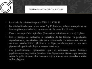 • Resultado de la infección por el VPH 6 ó VPH 11
• Lo más habitual es encontrar entre 5 y 15 lesiones, aisladas o en placas, de
base amplia o pediculadas, con un tamaño de entre 1 y 10 mm
• Tienen una superficie espiculada (formaciones similares a crestas) ó plana
• Con el tiempo de evolución, la superficie de las lesiones va perdiendo
espiculaciones y tornándose más lisa y redondeada y la coloración pasa de
un tono rosado inicial (debido a la hipervascularización) a uno más
pigmentado, pudiendo llegar a hacerse marrones.
• son proliferaciones epidérmicas que se observan como lesiones
papilomatosas, vegetantes, blandas, con digitaciones distales que semejan
cresta de gallo; tienen color rosado o rojo y son secas o húmedas si están
en los pliegues.
LESIONES CONDILOMATOSAS
 