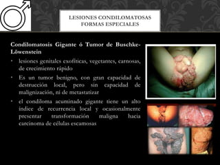Condilomatosis Gigante ó Tumor de Buschke-
Löwenstein
• lesiones genitales exofíticas, vegetantes, carnosas,
de crecimiento rápido
• Es un tumor benigno, con gran capacidad de
destrucción local, pero sin capacidad de
malignización, ni de metastatizar
• el condiloma acuminado gigante tiene un alto
índice de recurrencia local y ocasionalmente
presentar transformación maligna hacia
carcinoma de células escamosas
LESIONES CONDILOMATOSAS
FORMAS ESPECIALES
 