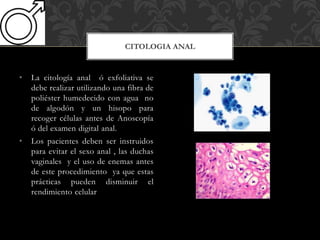 • La citología anal ó exfoliativa se
debe realizar utilizando una fibra de
poliéster humedecido con agua no
de algodón y un hisopo para
recoger células antes de Anoscopía
ó del examen digital anal.
• Los pacientes deben ser instruidos
para evitar el sexo anal , las duchas
vaginales y el uso de enemas antes
de este procedimiento ya que estas
prácticas pueden disminuir el
rendimiento celular
CITOLOGIA ANAL
 