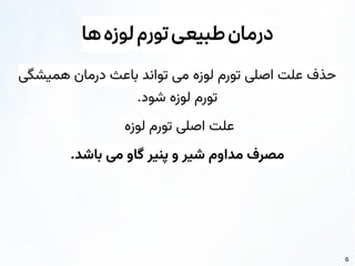 6
‫ها‬‫لوزه‬‫تورم‬‫طبیعی‬‫درمان‬
‫همیشگی‬ ‫درمان‬ ‫باعث‬ ‫تواند‬ ‫می‬ ‫لوزه‬ ‫تورم‬ ‫اصلی‬ ‫علت‬ ‫حذف‬
.‫شود‬ ‫لوزه‬ ‫تورم‬
‫لوزه‬ ‫تورم‬ ‫اصلی‬ ‫علت‬
.‫باشد‬ ‫می‬ ‫گاو‬ ‫پنیر‬ ‫و‬ ‫شیر‬ ‫مداوم‬ ‫مصرف‬
 