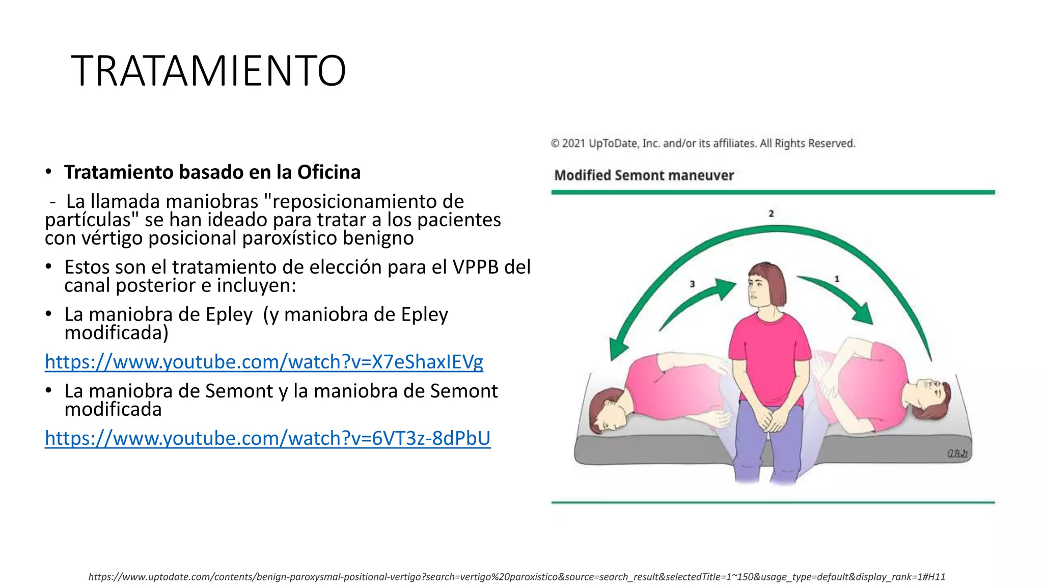 VÉRTIGO POSTURAL PAROXÍSTICO BENIGNO | PPTX