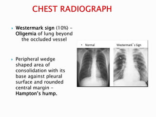 Watermark Sign Radiology VP pulmonary thmboembolism.pptx