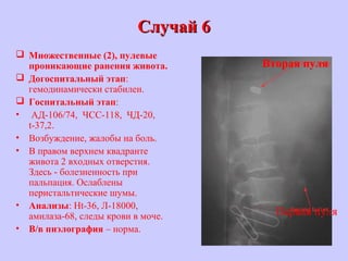 Случай 6Случай 6
 Множественные (2), пулевые
проникающие ранения живота.
 Догоспитальный этап:
гемодинамически стабилен.
 Госпитальный этап:
• АД-106/74, ЧСС-118, ЧД-20,
t-37,2.
• Возбуждение, жалобы на боль.
• В правом верхнем квадранте
живота 2 входных отверстия.
Здесь - болезненность при
пальпация. Ослаблены
перистальтические шумы.
• Анализы: Ht-36, Л-18000,
амилаза-68, следы крови в моче.
• В/в пиэлография – норма.
Первая пуля
Вторая пуля
 