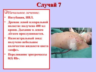 Случай 7Случай 7
Начальное лечение:
• Интубация, ИВЛ.
• Дренаж левой плевральной
полости: получено 400 мл
крови. Дыхание в левом
лёгком прослушивается.
• Назогастральный зонд:
получено небольшое
количество жидкости цвета
«кофе».
• Переливание эритромассы
0(I) Rh-.
 
