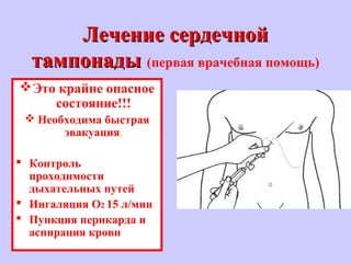 Лечение сердечнойЛечение сердечной
тампонадытампонады (первая врачебная помощь)
Это крайне опасное
состояние!!!
 Необходима быстрая
эвакуация.
 Контроль
проходимости
дыхательных путей
 Ингаляция O2 15 л/мин
 Пункция перикарда и
аспирация крови
 