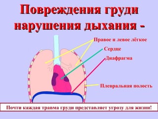 Повреждения грудиПовреждения груди
нарушения дыхания -нарушения дыхания -
Правое и левое лёгкое
Сердце
Диафрагма
Плевральная полость
Почти каждая травма груди представляет угрозу для жизни!
 