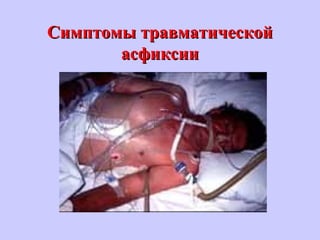 Симптомы травматическойСимптомы травматической
асфиксииасфиксии
 