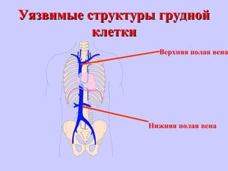 Уязвимые структуры груднойУязвимые структуры грудной
клеткиклетки
Верхняя полая вена
Нижняя полая вена
 