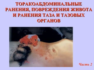 ТОРАКОАБДОМИНАЛЬНЫЕТОРАКОАБДОМИНАЛЬНЫЕ
РАНЕНИЯРАНЕНИЯ,, ПОВРЕЖДЕНИЯ ЖИВОТАПОВРЕЖДЕНИЯ ЖИВОТА
ИИ РАНЕНИЯ ТАЗА И ТАЗОВЫХРАНЕНИЯ ТАЗА И ТАЗОВЫХ
ОРГАНОВОРГАНОВ
Часть 2
 