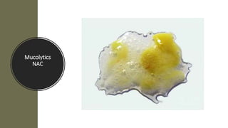 Mucolytics
NAC
 