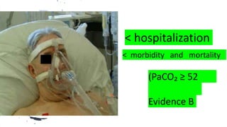 NPPV
< hospitalization
(PaCO₂ ≥ 52
Evidence B
< morbidity and mortality
 