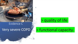 lung
transplantation
Evidence C
Very severe COPD
> quality of life
> functional capacity.
 