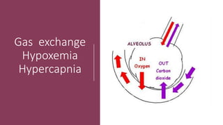 Gas exchange
Hypoxemia
Hypercapnia
 