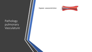 Pathology
pulmonary
Vasculature
Hypoxic vasoconstriction
 
